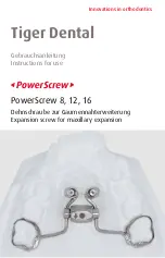 Tiger Dental PowerScrew 12 Instructions For Use Manual preview