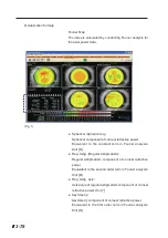 Preview for 128 page of Tomey TMS-5 Instruction Manual