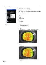 Preview for 134 page of Tomey TMS-5 Instruction Manual