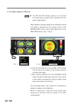 Preview for 178 page of Tomey TMS-5 Instruction Manual