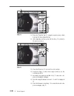 Preview for 64 page of Tomey UD-600 Operator'S Manual