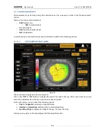 Preview for 79 page of Topcon ALADDIN User Manual