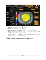 Preview for 81 page of Topcon ALADDIN User Manual