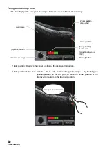 Предварительный просмотр 24 страницы Topcon DRI OCT-1 Triton User Manual