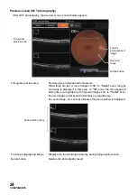 Предварительный просмотр 26 страницы Topcon DRI OCT-1 Triton User Manual