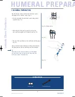 Preview for 14 page of Tornier Latitude Manual