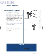 Preview for 15 page of Tornier Latitude Manual