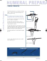 Preview for 16 page of Tornier Latitude Manual