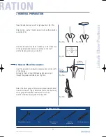 Preview for 17 page of Tornier Latitude Manual