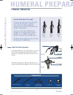 Preview for 18 page of Tornier Latitude Manual