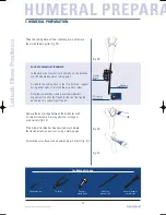 Preview for 20 page of Tornier Latitude Manual