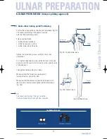 Preview for 25 page of Tornier Latitude Manual