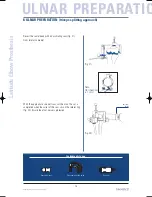 Preview for 26 page of Tornier Latitude Manual