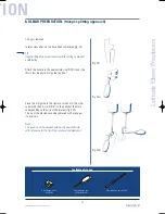 Preview for 27 page of Tornier Latitude Manual