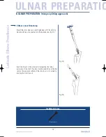 Preview for 28 page of Tornier Latitude Manual