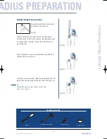 Preview for 31 page of Tornier Latitude Manual