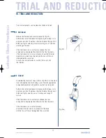 Preview for 32 page of Tornier Latitude Manual