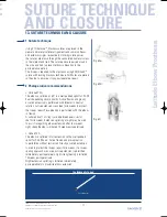 Preview for 37 page of Tornier Latitude Manual