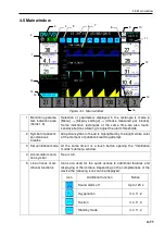 Preview for 59 page of Treaton MV200 User Manual