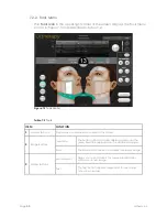 Preview for 46 page of Ulthera DeepSEE DS 4 - 4.5 Instructions For Use Manual