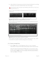 Preview for 53 page of Ulthera DeepSEE DS 4 - 4.5 Instructions For Use Manual