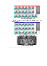 Предварительный просмотр 147 страницы Vatech A9 PHT-30CSS Technical Manual