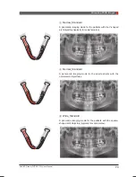 Preview for 73 page of Vatech PaX-i3D Smart User Manual