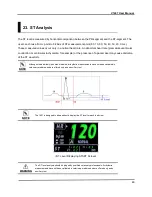 Preview for 49 page of Vetland V1407 User Manual