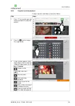 Предварительный просмотр 55 страницы videomed Truelink 4 Instructions For Use Manual