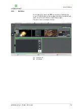 Предварительный просмотр 75 страницы videomed Truelink 4 Instructions For Use Manual