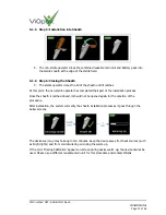 Preview for 12 page of ViOptix Intra.Ox 2.0 Instructions For Use Manual