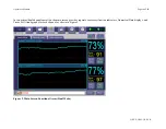 Preview for 18 page of ViOptix T.Ox OXY-2-USM-1 Operator'S Manual