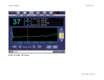 Preview for 37 page of ViOptix T.Ox OXY-2-USM-1 Operator'S Manual