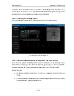 Preview for 65 page of Visiometrics HD Analyzer OQAS User Manual