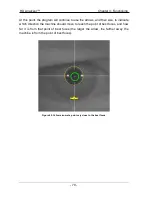 Preview for 70 page of Visiometrics HD Analyzer OQAS User Manual