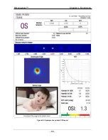 Preview for 80 page of Visiometrics HD Analyzer OQAS User Manual