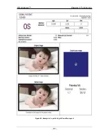 Preview for 81 page of Visiometrics HD Analyzer OQAS User Manual