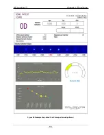 Preview for 84 page of Visiometrics HD Analyzer OQAS User Manual