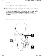 Предварительный просмотр 8 страницы Vitalograph BT12 ECG User Training Manual