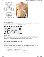 Предварительный просмотр 12 страницы Vitalograph BT12 ECG User Training Manual