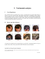 Preview for 17 page of Volu-Med HairMax LaserComb Premium User Manual