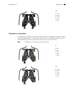 Preview for 25 page of Welch Allyn Connex ECG Module Directions For Use Manual