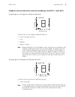 Preview for 35 page of Welch Allyn MicroTymp 3 Handle Directions For Use Manual