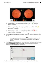 Предварительный просмотр 29 страницы Welch Allyn RetinaVue 700 Directions For Use Manual