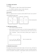 Предварительный просмотр 36 страницы WELL.D MEDICAL WED-3000V User Manual