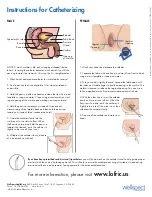 Preview for 2 page of Wellspect LoFric Series Instructions