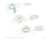 Preview for 33 page of Willow Breast Pump Generation 3 Instructions For Use Manual