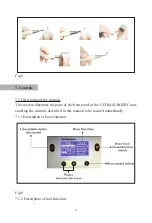 Preview for 15 page of Woodpecker ULTRASURGERY Manual Of Use And Maintenance