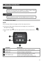 Предварительный просмотр 13 страницы WORMS SILENTSTAR 6000D M YN Instructions For Use Manual