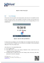 Preview for 47 page of Xblue Networks IP7g User Manual